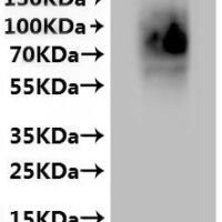 Mouse G-protein coupled bile acid receptor 1 (Gpbar1)-VLPs Recombinant Protein - BioCrest Sci