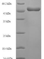 Lake Victoria marburgvirus Matrix protein VP40 (VP40) Recombinant Protein - BioCrest Sci
