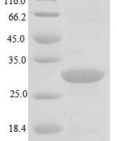 Helicobacter pylori Urease subunit alpha (ureA) Recombinant Protein, N-His, aa 1–238, E.coli - BioCrest Sci