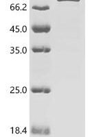 Mycobacterium ulcerans Ornithine carbamoyltransferase (argF), Biotinylated Recombinant Protein - BioCrest Sci