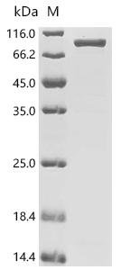 Mycobacterium ulcerans Ornithine carbamoyltransferase (argF), Biotinylated Recombinant Protein, Mycobacterium ulcerans (strain Agy99), E.coli, N-terminal MBP-tagged and C-terminal 6xHis-Avi-tagged, 81.2 kDa, purity >≥ 85% as determined by SDS-PAGE.