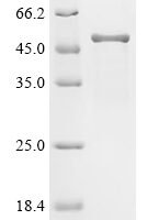 Chicken Alpha-N-acetylgalactosaminidase (NAGA) Recombinant Protein - BioCrest Sci