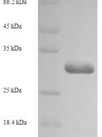 Rat Allograft inflammatory factor 1 (Aif1) Recombinant Protein, N-His-SUMO - BioCrest Sci