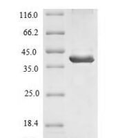 Human Signal-regulatory protein beta-1 (SIRPB1), partial Recombinant Protein, N-His, aa 30–371, E.coli - BioCrest Sci