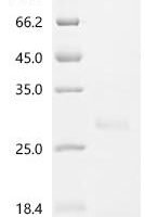 Alternaria alternata Superoxide dismutase [Cu-Zn] Recombinant Protein - BioCrest Sci