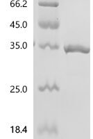 Human Transcription factor E2-alpha (TCF3), partial Recombinant Protein, N-GST/C-His - BioCrest Sci