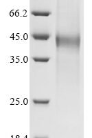 Newcastle disease virus Hemagglutinin-neuraminidase4 (HN), partial Recombinant Protein - BioCrest Sci