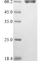 Mouse Chitinase-like protein 4 (Chil4) Recombinant Protein - BioCrest Sci