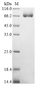 Mouse Chitinase-like protein 4 (Chil4) Recombinant Protein, Mus musculus (Mouse), Mammalian cell, C-terminal hFc1-tagged, 71.8 kDa, purity >≥ 90% as determined by SDS-PAGE.