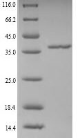 Aedes aegypti Long form salivary protein D7L1 (D7) Recombinant Protein, N-His, aa 18–321, Yeast - BioCrest Sci