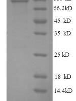 Human NADPH--cytochrome P450 reductase (POR), partial Recombinant Protein, N-GST - BioCrest Sci
