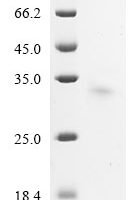 Mouse Usherin (Ush2A), partial Recombinant Protein - BioCrest Sci