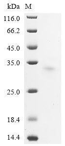 Mouse Usherin (Ush2A), partial Recombinant Protein, Mus musculus (Mouse), Yeast, C-terminal 6xHis-tagged, 30.7 kDa, purity >≥ 90% as determined by SDS-PAGE.