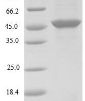 BK polyomavirus Minor capsid protein VP2 Recombinant Protein, N-His, aa 2–351, E.coli - BioCrest Sci