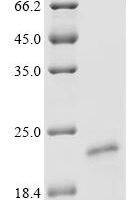 Human Heparanase (HPSE), partial Recombinant Protein, N-His-SUMOstar - BioCrest Sci