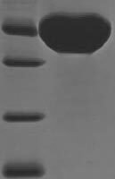 Viscum album Beta-galactoside-specific lectin 1, partial Recombinant Protein - BioCrest Sci