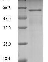 Mouse Leucine-rich repeat and immunoglobulin-like domain-containing nogo receptor-interacting protein 1 (Lingo1), partial Recombinant Protein, N-His, aa 37–555, E.coli - BioCrest Sci