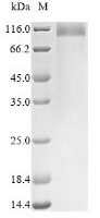 Mouse Uromodulin (Umod), partial Recombinant Protein - BioCrest Sci