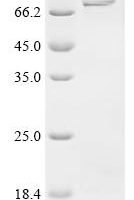 Mouse Glutamate--cysteine ligase catalytic subunit (Gclc) Recombinant Protein - BioCrest Sci
