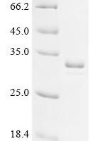Escherichia coli 2,3-bisphosphoglycerate-dependent phosphoglycerate mutase (gpmA) Recombinant Protein, C-His - BioCrest Sci