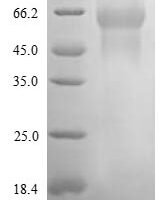 Rat Neogenin (Neo1), partial Recombinant Protein - BioCrest Sci