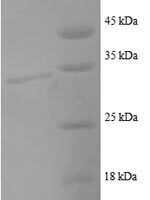 Human C-C motif chemokine 22 (CCL22), partial Recombinant Protein - BioCrest Sci