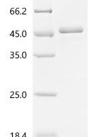 Human Integrin alpha-IIb (ITGA2B), partial Recombinant Protein, C-His - BioCrest Sci