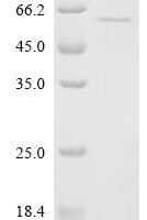 Tick-borne encephalitis virus Far Eastern subtype Genome polyprotein, partial Recombinant Protein, C-His - BioCrest Sci