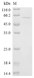 Tick-borne encephalitis virus Far Eastern subtype Genome polyprotein, partial Recombinant Protein, C-His, Tick-borne encephalitis virus Far Eastern subtype (strain Sofjin) (SOFV) (Sofjin virus), E.coli, C-terminal 6xHis-tagged, 55.6 kDa, purity >≥ 85% as determined by SDS-PAGE.