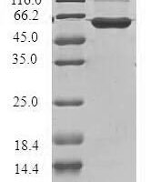 Human G1/S-specific cyclin-D3 (CCND3) Recombinant Protein - BioCrest Sci