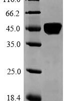 Human Laminin subunit alpha-5 (LAMA5), partial Recombinant Protein - BioCrest Sci