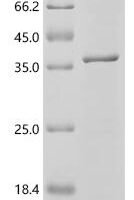 Bordetella pertussis BrkA autotransporter (brkA), partial Recombinant Protein, C-His, aa 732–1010 - BioCrest Sci