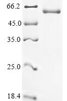 Human Leucine-rich repeat-containing G-protein coupled receptor 6 (LGR6), partial Recombinant Protein - BioCrest Sci