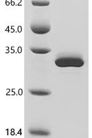 Human Myocilin (MYOC) Recombinant Protein - BioCrest Sci