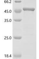 Human Mevalonate kinase (MVK) Recombinant Protein - BioCrest Sci