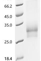 Human T-cell surface glycoprotein CD8 alphaβ Heterodimer Protein (CD8A&CD8B) Recombinant Protein - BioCrest Sci