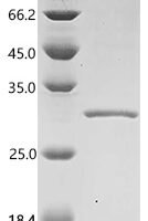 Vibrio cholerae serotype O1 Sialidase (nanH), partial Recombinant Protein, C-His - BioCrest Sci