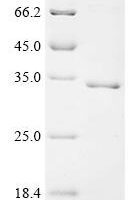 Triticum aestivum Aluminum-activated malate transporter 1 (ALMT1), partial Recombinant Protein - BioCrest Sci