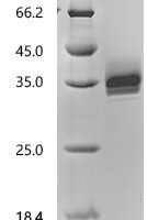 Macaca mulatta Epithelial cell adhesion molecule (TACSTD1), partial Recombinant Protein - BioCrest Sci