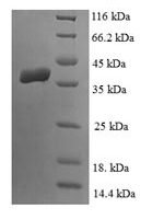 Human Lipoyl synthase, mitochondrial (LIAS) Recombinant Protein, N-His - BioCrest Sci