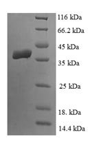 Human Lipoyl synthase, mitochondrial (LIAS) Recombinant Protein, N-His, Homo sapiens (Human), E.coli, N-terminal 6xHis-tagged, 42.9 kDa, purity >≥ 90% as determined by SDS-PAGE.
