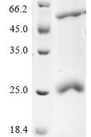 Human coronavirus HKU1 Protein I (N) Recombinant Protein, C-His - BioCrest Sci