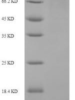 Human Macrophage mannose receptor 1 (MRC1), partial Recombinant Protein, N-His-SUMO - BioCrest Sci