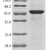 Human L-2-hydroxyglutarate dehydrogenase, mitochondrial (L2HGDH) Recombinant Protein, N-His-SUMO, Isoform 2, Mature - BioCrest Sci