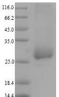 Salmonella enterica subsp. OmpA family protein (A673_03341), partial Recombinant Protein - BioCrest Sci