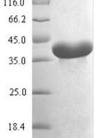 Mycoplasma pneumoniae Methionine aminopeptidase (map) Recombinant Protein - BioCrest Sci