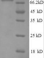 Human E3 ubiquitin-protein ligase RAD18 (RAD18) Recombinant Protein - BioCrest Sci