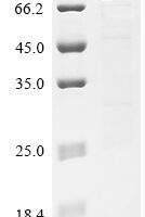 Human Receptor-interacting serine/threonine-protein kinase 2 (RIPK2) Recombinant Protein, N-GST - BioCrest Sci