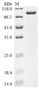 Human Receptor-interacting serine/threonine-protein kinase 2 (RIPK2) Recombinant Protein, N-GST, Homo sapiens (Human), E.coli, N-terminal GST-tagged, 87.9 kDa, purity >≥ 85% as determined by SDS-PAGE.