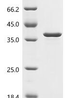Escherichia coli O6:H1 DNA-binding dual transcriptional regulator OmpR (ompR) Recombinant Protein, C-His - BioCrest Sci